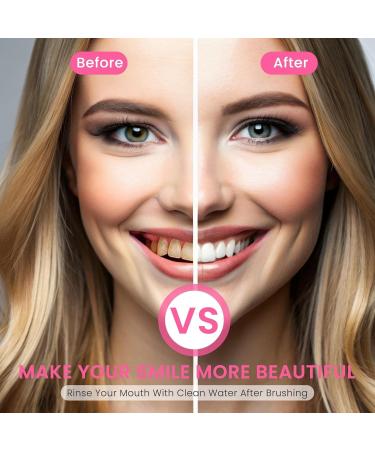 2 Pack BodyAccel Niacinamide Whitening Toothpaste Triple Whitening Niacinamide Toothpaste Brightens and Whitens Teeth Natural Gentle Fresh Breath 2pack - Buy Online on GoSupps.com