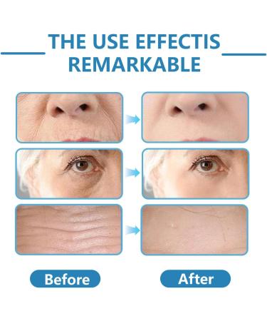  MagiSel B5 Firming Serum B5 Anti-Wrinkle and Fine Line Serum 30ml for the Face Effectively Reduces Pores Eliminates Acne and Firms the Skin Face Reduces Fine Lines - Buy Online on GoSupps.com