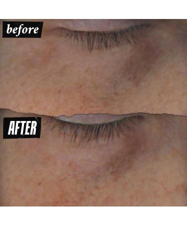Buy Kiehl's Powerful-Strength 10% Vitamin C Eye Serum | Reduces Dark Circles & Puffiness Hydrates & Smooths Undereye - 0.5 fl oz | International Shipping Available - Buy Online on GoSupps.com