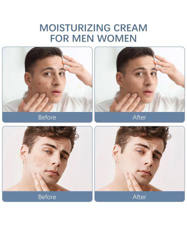 Norse Organics Acne & Redness Killer - Best Acne Balm & Killer (2PC) for Clear Skin | Shop Internationally - Buy Online on GoSupps.com