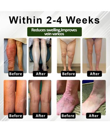 ATTDX FluidEase Leg Cream Natural herbal cream Comprehensive care for all skin types (4) - Buy Online on GoSupps.com