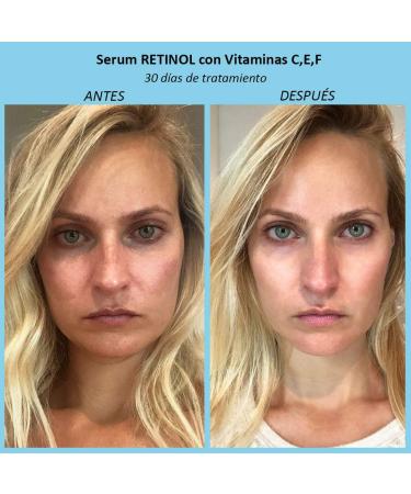 AVA LABORATORIUM YOUTH ACTIVATOR RETINOL FACE SERUM WITH C E F VITAMINS 30ml - Buy Online on GoSupps.com