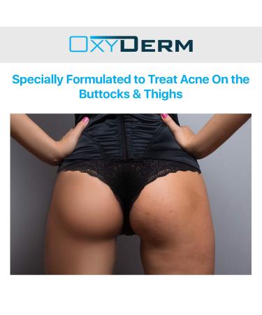 Acne Clearing Peel Pads for Butt & Thighs - Eliminate Pimples, Blemishes & Ingrown Hairs - For Men & Women - Buy Online on GoSupps.com