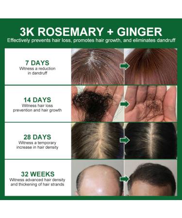 Rosemary Hair Regrowth Essential Oil - Organic Hair Loss Serum for Stronger Roots | 1.69 Fl Oz - Unisex Adult - Buy Online on GoSupps.com