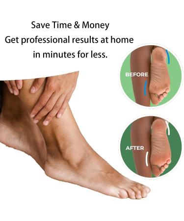 4 Foot Teplacement Rollers for Effective Foot Care Exfoliating and Removing Dead Skin and Calluses 2 Rough Level Coarse Sand and Fine Sand (Black Gray) - Buy Online on GoSupps.com