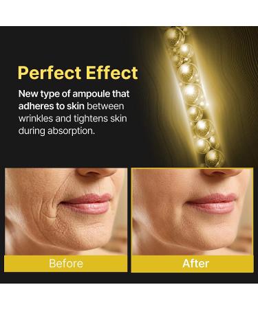 MEDITIME Botalinum Ampoule | Peptide Hyaluronic Acid Serum for Face | Reduce Wrinkles & Fine Lines | Skincare Serum for Forehead, Lip, Under Eye, Neck | Night Serum for Lifting & Firming - Buy Online on GoSupps.com