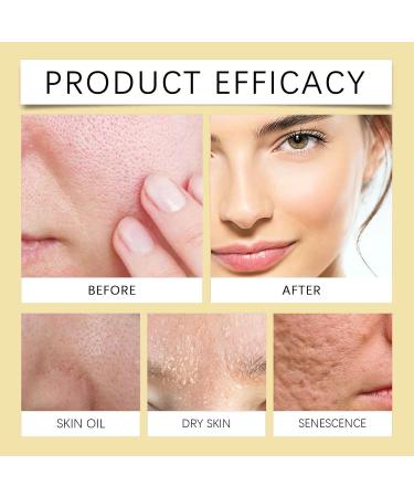 Generisch Aktiv - Resin Ointment - For enlarged pores - Oil-reducing cream - Moisturizing cream - Resin ointment for irritated and dry skin - For all skin types - Buy Online on GoSupps.com