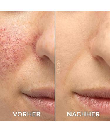 carvenchy Vitamin C Facial Serum Essence Hydration Skin Moisturized Brightens Skin Tone Moisturizes and Hydrates - Buy Online on GoSupps.com