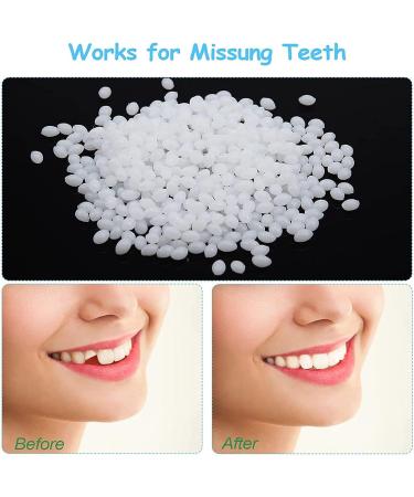 Buy Giural Veneer Teeth - Instant Snap-In Dental Veneers for Men & Women | Fake Teeth for a Brighter Smile - International Shipping Available - Buy Online on GoSupps.com