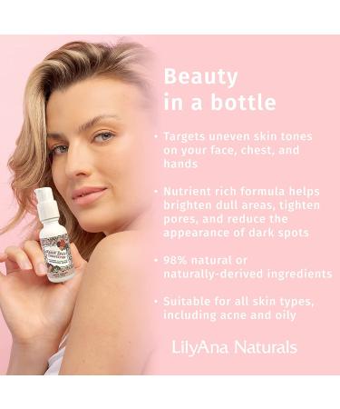 LilyAna Naturals Dark Spot Corrector - Brightening Face Serum with Niacinamide and Kojic Acid - 1oz - Buy Online on GoSupps.com