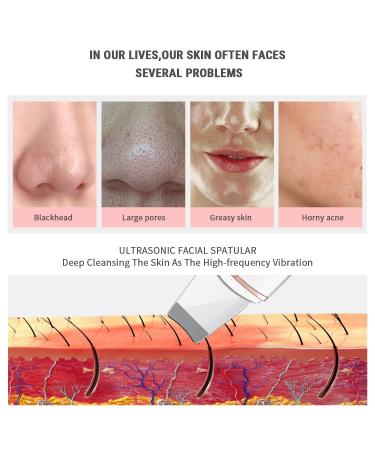 Skin Scrubber and Spatula Set with 4 Modes | Pore Cleanser, Blackhead Remover, Exfoliator | Includes 4 Acne Removal Tools - Buy Online on GoSupps.com