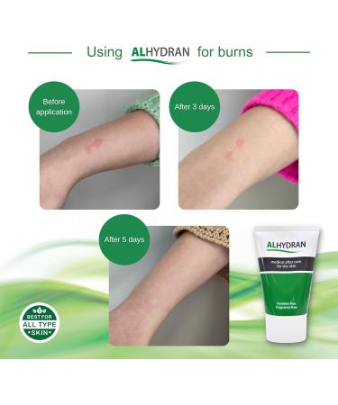 Alhydran After Care for Skin | 100ml - Scars, Dry Skin, Eczema, Itching, Burns, Wounds | Post-Radiotherapy & Surgery Skin Relief - Buy Online on GoSupps.com