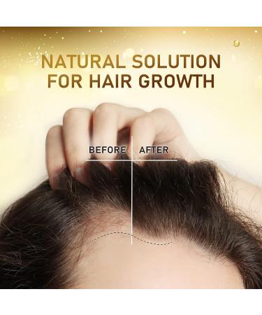 Biotin Hair Growth Serum with Castor Oil & Argan Oil for Women - Hair Loss Prevention and Regrowth Treatment by Beaueli - Buy Online on GoSupps.com