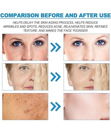 B5 Face Serum Hyaluronic Acid Serum with Vitamin B5 Bo-tox Face Serum Anti Aging Serum Instant Face Firming & Plumping Face Fade Fine Lines Bo-tox Face Serum B5 Face Moisturiser 30ml - Buy Online on GoSupps.com