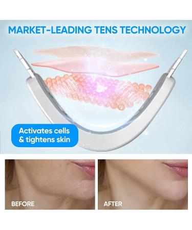 Machine de r duction de double menton ceinture de beaut lectrique for dispositif de levage du visage en V masseur de mise en forme du visage intelligent portable avec lumi re bleue /697 (Color : White - Buy Online on GoSupps.com