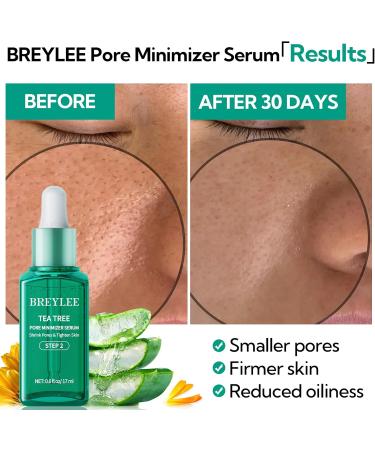 BREYLEE Masque anti-points noirs & s rum minimiseur de pores bandes de nez l'huile d'arbre th + 100 papiers raffermissement de contr le de l'huile peau resserr e et raffermissante Kit de nettoyage des pores nasaux - Buy Online on GoSupps.com