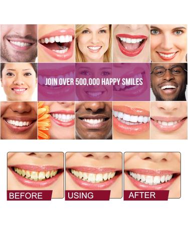 Lightening Toothpaste - 2 Pack | Freshens Breath Removes Tartar Stains & Cleans Teeth | Best Toothpaste for Stain Removal - Buy Online on GoSupps.com