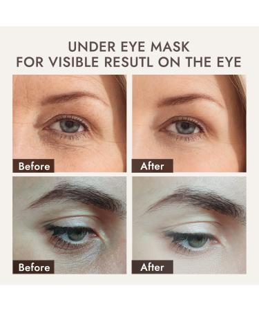 Herg Under Eye Cream Patches - Wrinkle Treatment & Rejuvenating Masks for Dark Circles - 7 Pairs - Buy Online on GoSupps.com