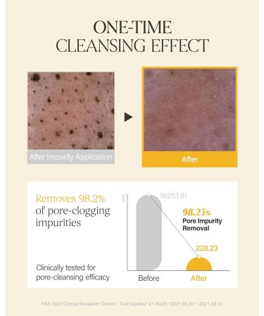 ABOUT ME Rice Makgeolli Skin Softener + About Me Rice Makgeolli Cleansing Foam Bundle - Buy Online on GoSupps.com