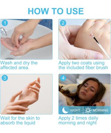 Skin Tag and Mole Removal Lotion - Fast-Acting Natural Remover for Warts - Easy Home Treatment (2PCS 40ML) - Buy Online on GoSupps.com