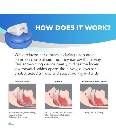 Anti Snoring Devices: Snoring Solution - Snoring Mouth Guard - Stop Snoring Devices - Anti Snoring Mouthpiece - Mouth Guard for Snoring - Night Guard for Grinding Teeth - Snore Guard Clear - Buy Online on GoSupps.com