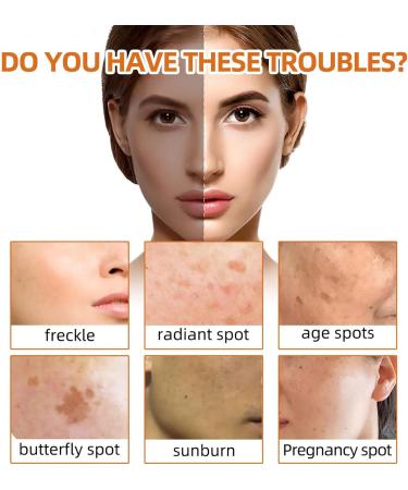 Turmeric Soap | Skin Lightening Kojic Acid Soap | Soap Bars for Hyperpigmentation Acne Spot Removal - Buy Online on GoSupps.com