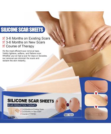 Silicone Gel Scar Patch - Fade Stretch Marks, Burns & Cuts, Smooth Skin - Tinted Face Moisturizer - One Size - Buy Online on GoSupps.com
