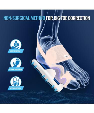 Fit Geno Upgraded Bunion Corrector - 2 Pcs Non-Surgical Toe Corrector for Hallux Valgus Pain Relief - Comfortable & Breathable - Day/Night Support for Men & Women - Buy Online on GoSupps.com