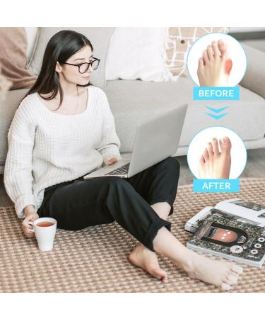 Silicone Toe Protectors - 40 Pcs for Ingrown Toenails, Corns, Calluses, Blisters - Clear Toe Caps for Pain Relief - Buy Online on GoSupps.com