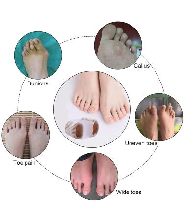 6PCS Toe Separators - Toe Hallux Valgus Corrector for Men and Women - Toe Spacers for Overlapping Toes and Hammer Toes - Buy Online on GoSupps.com