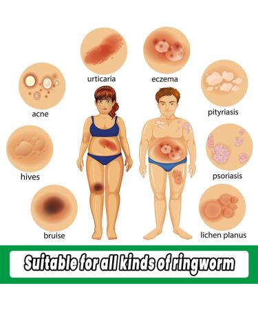  MagiSel Eczema Skin Care Cream 20g Anti Itch Cream Improves Dry Skin - Buy Online on GoSupps.com