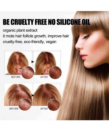  JPSDOWS Rosemary Soap for Hair Growth | Rosemary Shampoo for Hair Growth Rosemary Deep Cleansing Shampoo for Fine and Oily Hair Jpsdows - Buy Online on GoSupps.com