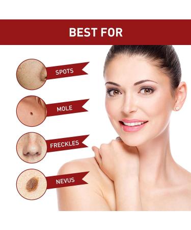 Aibyks 2 Skin Tag Corrector | Natural Mole Remover Cream Natural Skin Tag Removal Mole Corrector for Face Wart and Body Wart - Buy Online on GoSupps.com