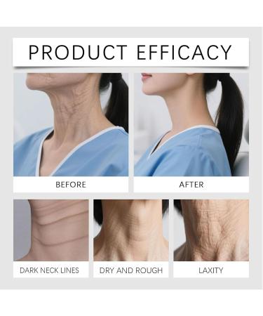  yxcully Firming face cream - Champagne lifting face cream for face and neck deep hydration smooths wrinkles and fine lines anti-aging restores skin elasticity (2 pcs) - Buy Online on GoSupps.com