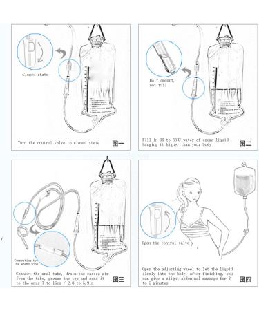 Shanrya Enema Bag Set - 1200 ML Hook Design Large Valve | Best Enema Kit for Home Use - Buy Online on GoSupps.com