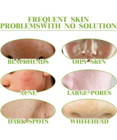 Mousse Nettoyante Au Th Vert - Nettoyant Visage Hydratant Contr le Du S bum Quotidien Rafra chissant Et Non Dess chant(2PCS) - Buy Online on GoSupps.com