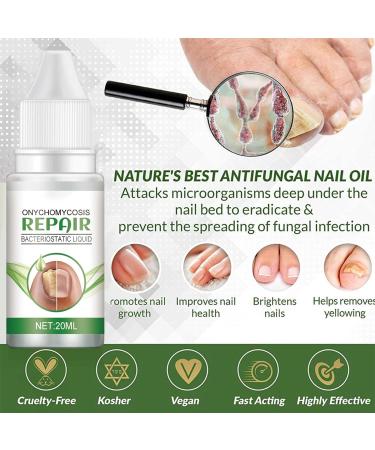 Fungal Nail Serum for Toenails Extra Strong Natural Anti Fungal Nail Serum Severe Fungal Nail Serum for Toenails and Fingernails Anti fungus Nail Improve and Strengthen - Buy Online on GoSupps.com