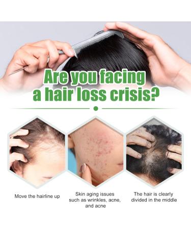 Castor Oil for Hair - Castor Oil Cold Pressed | Natural Hair Growth Oil with Castor | Strengthening Nourishing Hair Regrowth Oil | Hair Thickening Oil 30ml Promotes Longer Thicker Hair - Buy Online on GoSupps.com