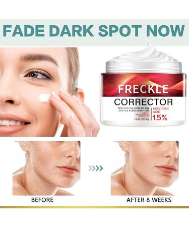 Anti Freckle Face Cream - Skin Lig_htening Cream - Vitamin C Cream for Dark Spot Remove - Hydrating Face Cream for Dry Skin - Face Moisturizer for Women - Even Skin Tone Anti Aging - 30g - Buy Online on GoSupps.com