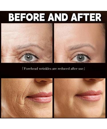 Retinol Moisturizer Anti Aging Cream Face Moisturiser with Hyaluronic Acid for Women Men Anti Wrinkle Face Cream with 2.5% Retinol Cream Face Cream Reduce Fine Lines Deep Hydration Cream 50g - Buy Online on GoSupps.com