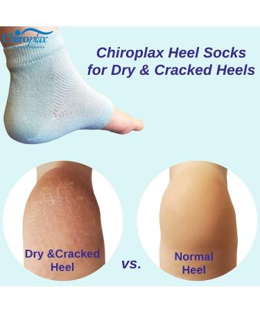 Chiroplax Vented Moisturizing Heel Socks - 2 Pairs (Mint) | Gel Lining Spa Sleeve Toeless Socks for Dry Cracked Heels - Buy Online on GoSupps.com