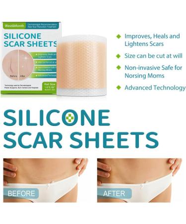 Teksome Scar Tape for Body - 1.5m Stretch Mark Remover Strips | Silicone Gel Tape for Scars & Stretch Marks - Buy Online on GoSupps.com