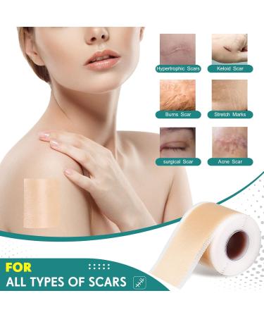 Silicone Scar Tape 1.6 x 60 Roll - Reusable Professional Scar Removal Strips for Surgical Scars, Keloid, C-Section, Burn, Acne - Silicone Scar Sheets for Effective Scar Away Treatment - Buy Online on GoSupps.com