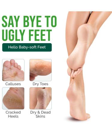 VeraCare Lavender Foot Peel Mask - 2 Pairs - Exfoliating & Moisturizing Treatment for Cracked Heels, Dead Skin & Calluses - Baby Soft Feet Results - Buy Online on GoSupps.com