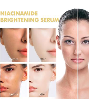 KOAHDE Nicotinamide Brightening Essence Nicotinamide Moisturizing Serum Whitening Anti-Aging Essence Moisturizing and Brightening Skin Nicotinamide Skin Brightening Essence Moisturizing & Rejuvenating - Buy Online on GoSupps.com
