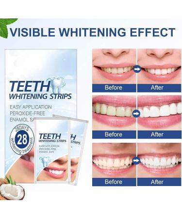 Premium Teeth Whitening Strips - Peroxide-Free Safe for Enamel Quick Results - 28 Strips for White Teeth Sensitivity - Buy Online on GoSupps.com
