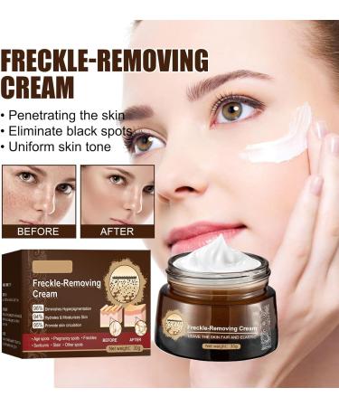 KOAHDE Freckle Removal Cream For Face Freckle Cream Anti Melasma Facial Moisturize Cream Moisturizing Anti-Blemish Cream Pigmentation Removal Cream for Face Skin Brightening Cream Dark Spot Corrector - Buy Online on GoSupps.com