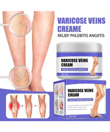 HADAVAKA Vein Care Fading Cream Varicose Vein Cream Leg Swelling Earthworm Leg Care Improve Blood Circulation Relieve Pain of Legs 2 - Buy Online on GoSupps.com