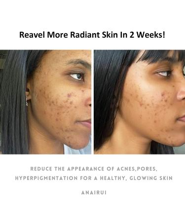 ANAI RUI Turmeric Clay Face Mask with Vitamin C & Aloe - Acne & Dark Spots Treatment, 4.23 oz - Buy Online on GoSupps.com