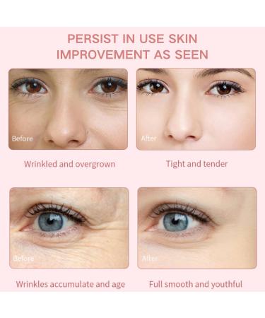 Niacinamide Serum - Hyaluronic Acid Serum for Face - Face Serum for Women - Skin Care for Dark Spot Correcting Glow Serum - Face Serum for Anti-Ageing and Wrinkles - Buy Online on GoSupps.com